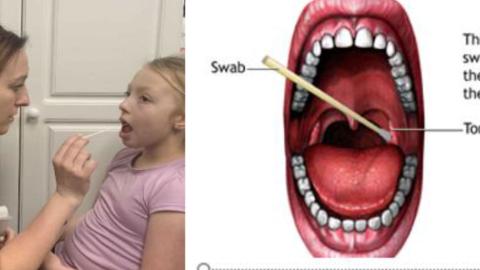 How to swab the throat